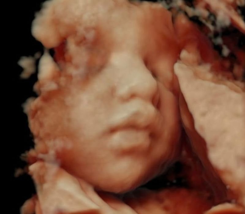 Obstetricia y control prenatal